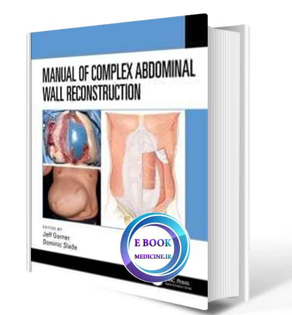 دانلود کتاب Manual of Complex Abdominal Wall Reconstruction2020( ORIGINAL PDF)